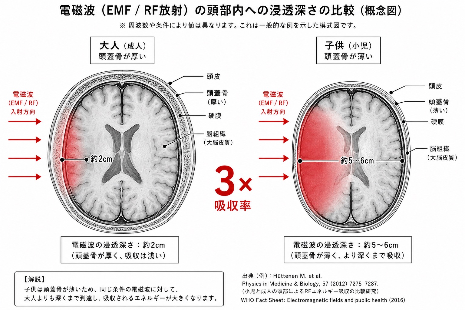 大人と子供の頭蓋骨断面比較 — 電磁波浸透深度